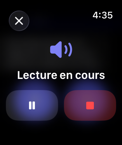 Commandes de réponse vocale de RouterChat sur Apple Watch