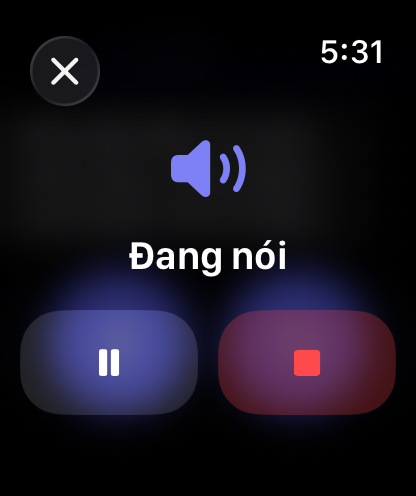 Các nút điều khiển phản hồi bằng giọng nói của RouterChat trên Apple Watch